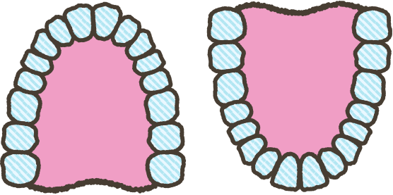 従来の矯正方法