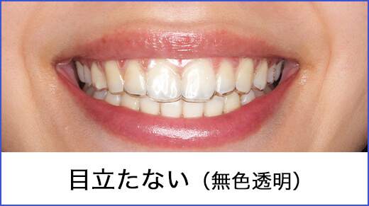 見た目 目立たない
