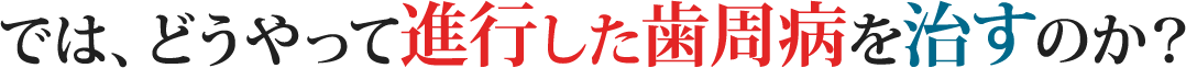 では、どうやって進行した歯周病を治すのか？