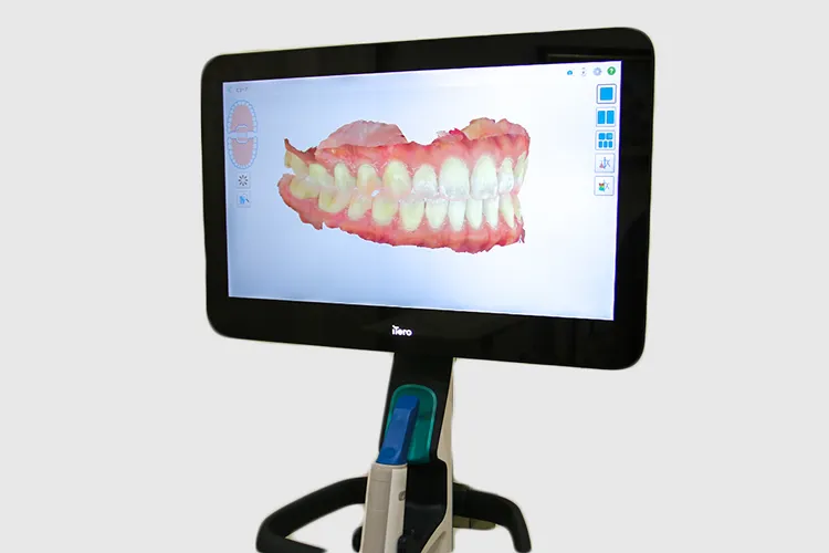 iTero