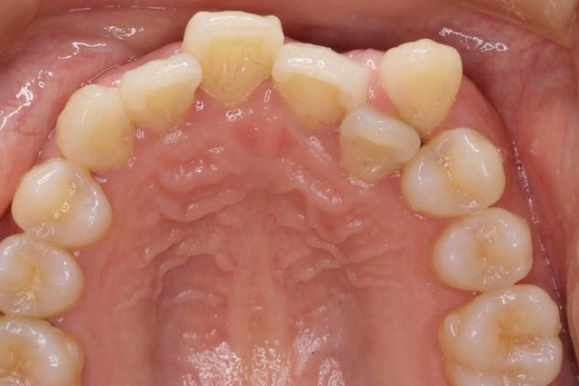 歯の位置異常にかかわる治療