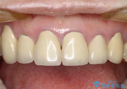 この際全てをしっかりと治療したい 総合歯科治療の治療前