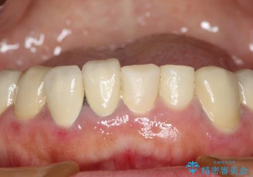 この際全てをしっかりと治療したい 総合歯科治療の治療前