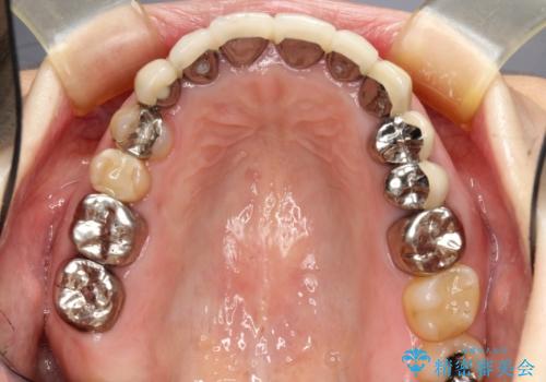 この際全てをしっかりと治療したい 総合歯科治療の治療前