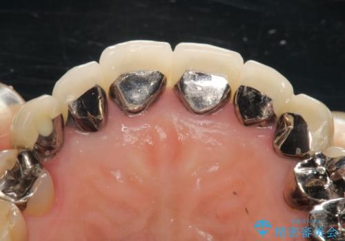 この際全てをしっかりと治療したい 総合歯科治療の治療前