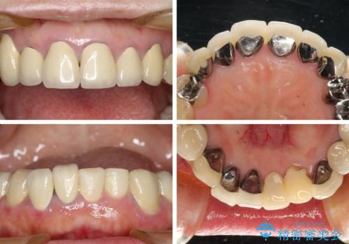 この際全てをしっかりと治療したい 総合歯科治療の治療前