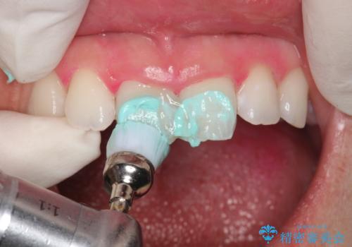 毎月のメンテナンスの治療中