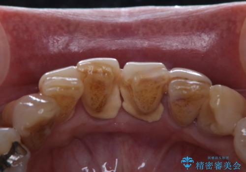 久しぶりのPMTCでメンテナンス