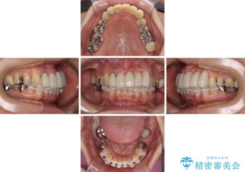 気になる所を一気に治療 総合歯科治療の治療中
