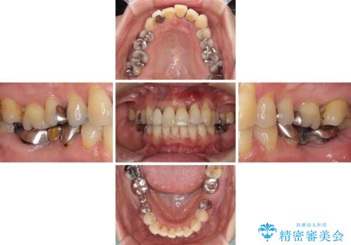 気になる所を一気に治療 総合歯科治療の治療前