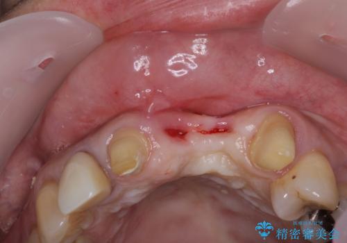 気になる所を一気に治療 総合歯科治療の治療前