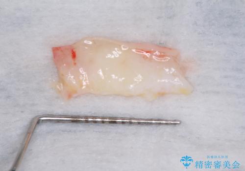 気になる所を一気に治療 総合歯科治療の治療中