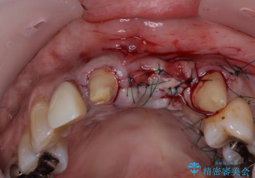 気になる所を一気に治療 総合歯科治療の治療後