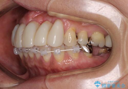 気になる所を一気に治療 総合歯科治療の治療中