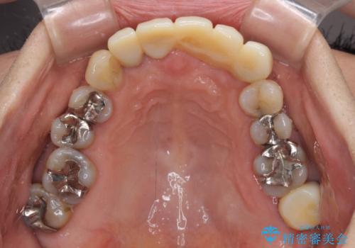 気になる所を一気に治療 総合歯科治療の治療中