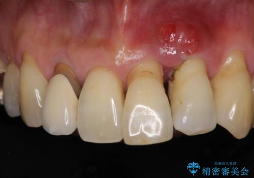 気になる所を一気に治療 総合歯科治療の治療前