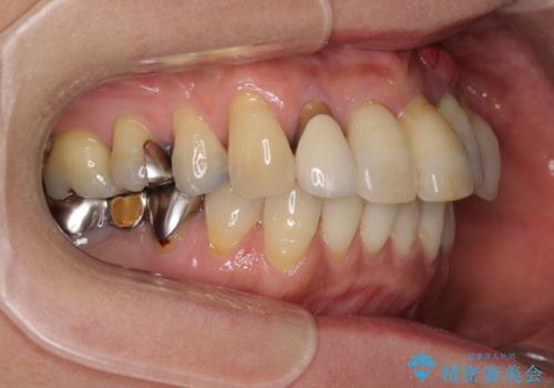 気になる所を一気に治療 総合歯科治療の治療前