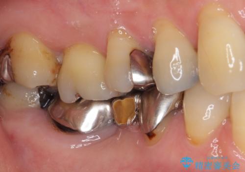 気になる所を一気に治療 総合歯科治療の治療前