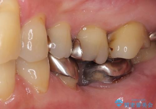 気になる所を一気に治療 総合歯科治療の治療前