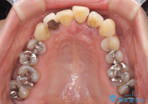 気になる所を一気に治療 総合歯科治療の治療前