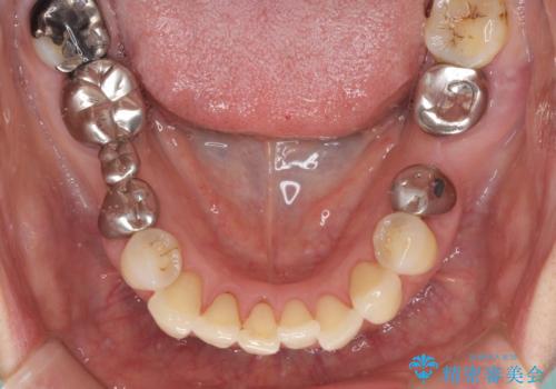 気になる所を一気に治療 総合歯科治療の治療前
