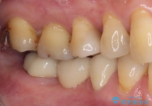 気になる所を一気に治療 総合歯科治療の治療後