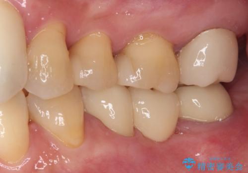 気になる所を一気に治療 総合歯科治療の治療後