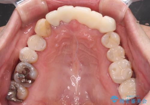 気になる所を一気に治療 総合歯科治療の治療後
