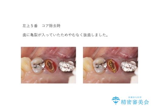 全体をきちんと治したいの治療中
