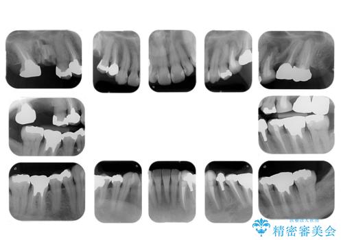 全体をきちんと治したいの治療前
