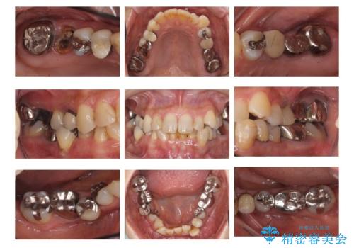 全体をきちんと治したい