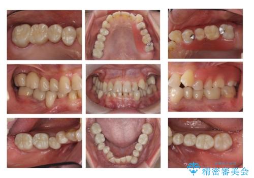 全体をきちんと治したいの症例 治療後