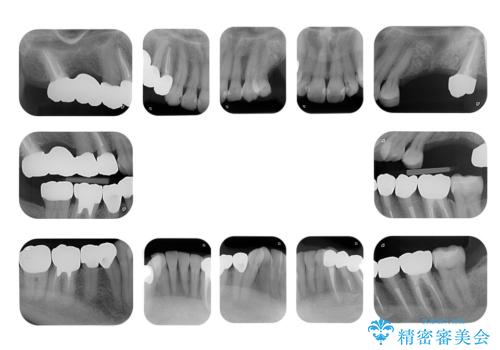 全体をきちんと治したいの治療後