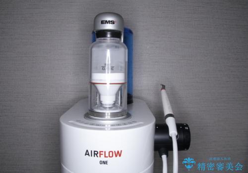 しぶといステインもエアフローワンで1日でキレイに!!の治療中