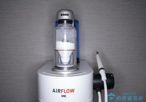 コーヒーなどでついた濃い着色の除去の治療中