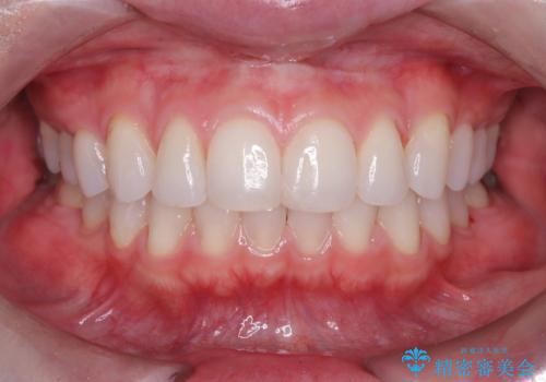 艶感アップになるクリーニング