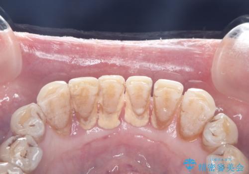 クリーニングでスッキリ!