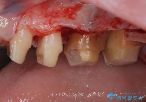 かかりつけ医の治療方針に疑問　歯周病治療と矯正治療を合わせた総合歯科治療の治療中