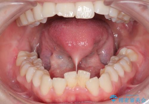 滑舌を良くしたい。